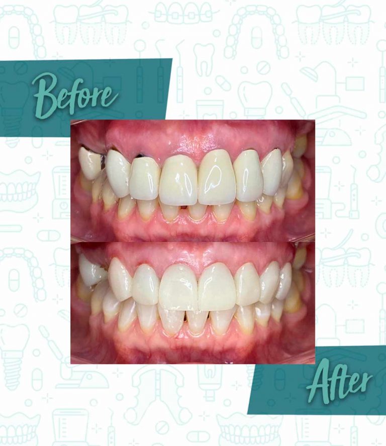 Tips on how to find a reputable dentist in your area through online reviews, recommendations, and professional associations.