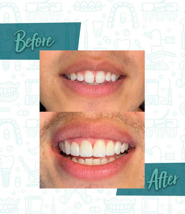 Importance of visiting the dentist regularly for preventive care and early detection of dental issues.