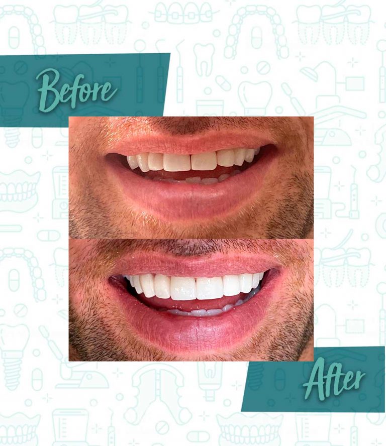 Role of the dentist in maintaining oral hygiene